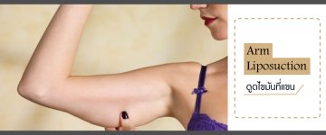 Arm Liposuction