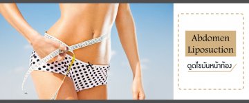 Abdomen Liposuction