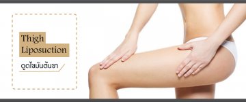 Thigh Liposuction